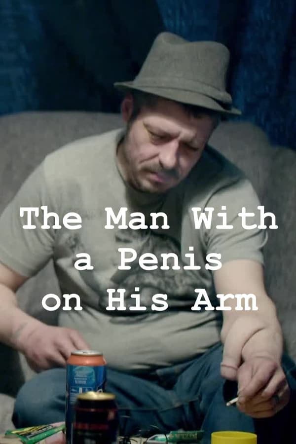 |NL| The Man With a Penis on His Arm