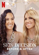 NF - Skin Decision: Before and After (US)